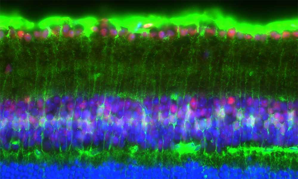 Section of the mouse retina
