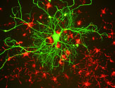 Dr. Olsen image of neurons